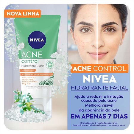 NIVEA-Hidratante-Facial-Acne-Control-50ml--4